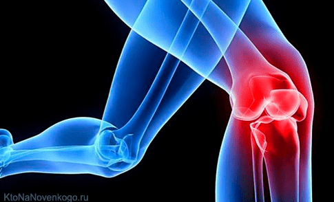 Arthroza