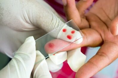 Diagnoza bolečine v sklepih prstov