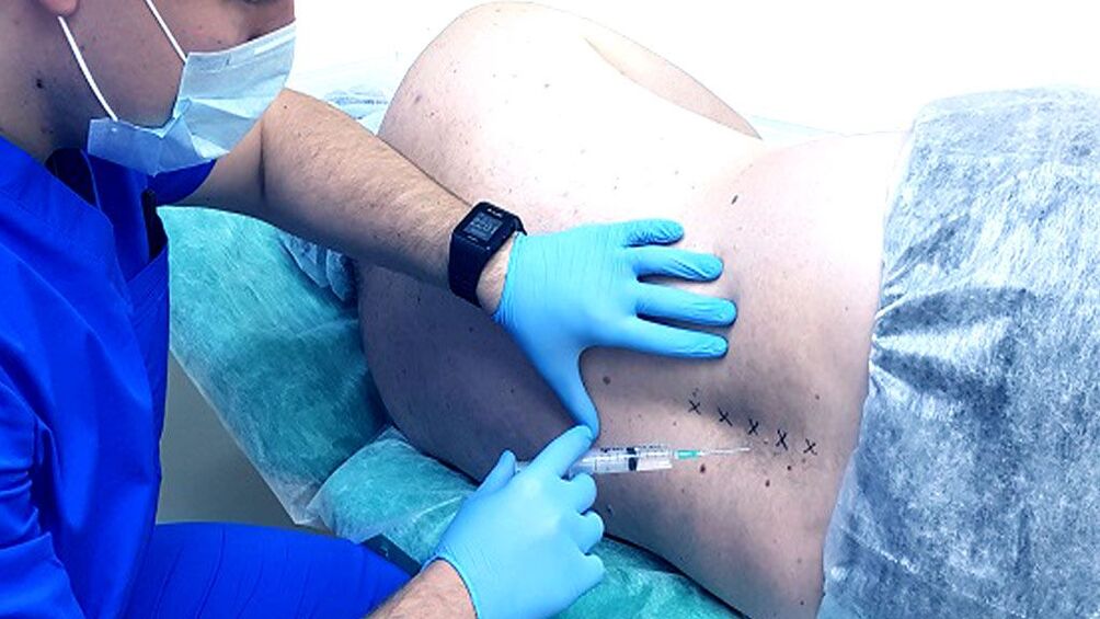 Hrbtenični blok za osteohondrozo