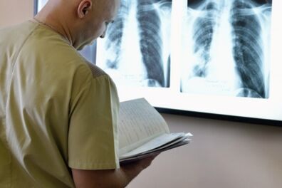 Rentgen prsne hrbtenice za diagnozo osteohondroze